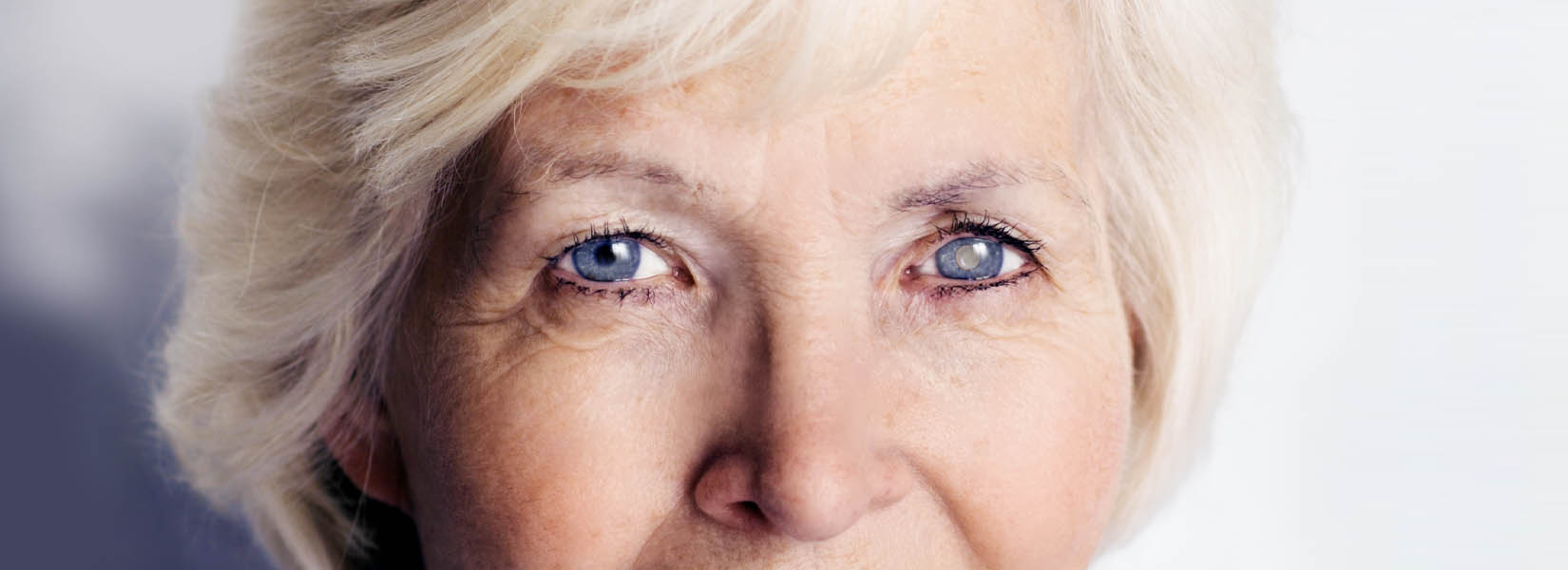 Cataract Surgery in Perrysburg